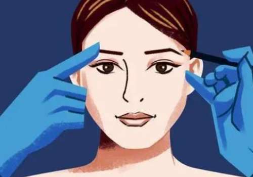 哈医大一院吕冰洁双眼皮修复怎么样？技术优势与案例分享，附价格表插图3