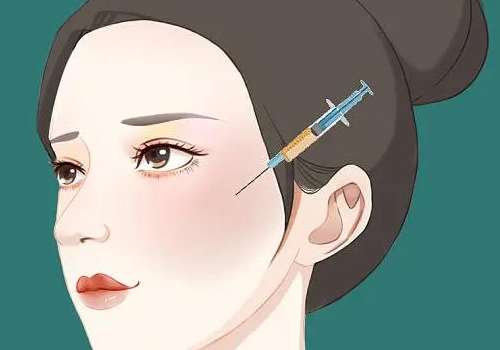 北京巩敏脂肪填充好吗？各大爱美人士口碑反馈曝光！插图2