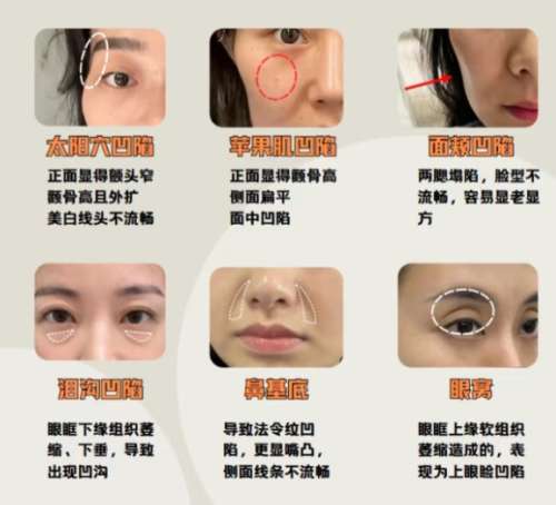 杭州面部填充医生都有谁？实力专家名单公布！插图3