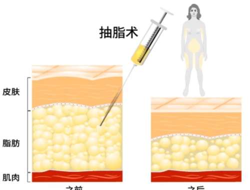 上海九院李华的口碑和评价高不高？医生热门项目技术盘点！插图4