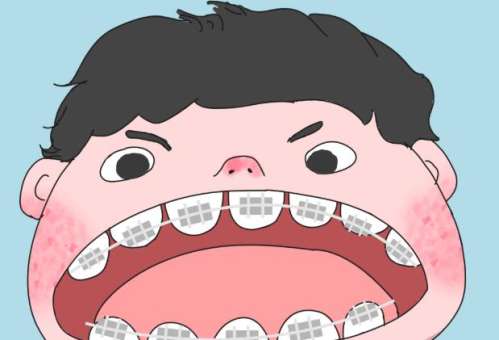 上海九院正畸冯静怎么样？技术亮点解析插图1