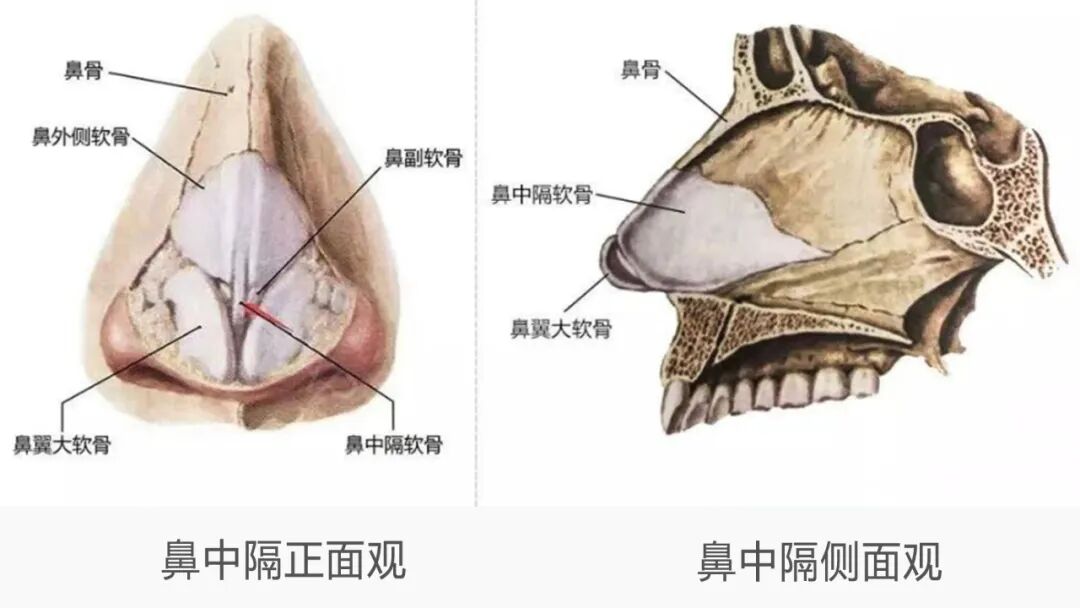 隆鼻技术 | 鼻尖整形中建议取鼻中隔软骨吗？插图