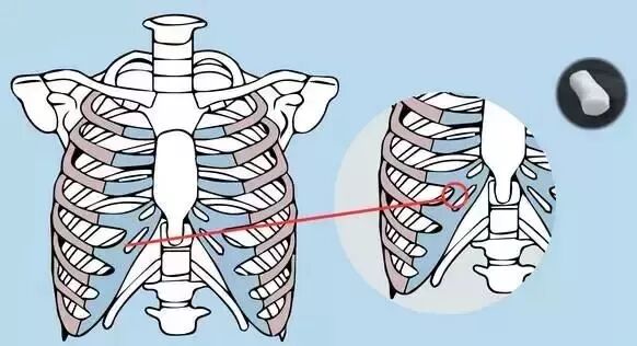 这么多种隆鼻材料，要怎么选？插图4