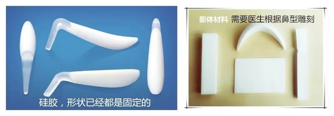 隆鼻方法这么多，到底是假体好，注射好，还是自体好?插图1