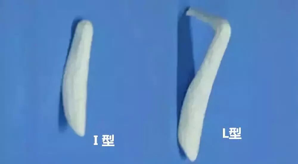 隆鼻方法这么多，到底是假体好，注射好，还是自体好?插图5