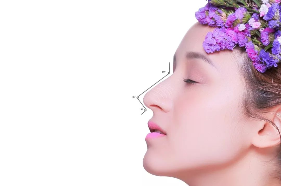 耳软骨、肋软骨、鼻中隔，用它们隆鼻有啥区别？插图3