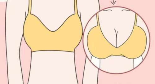 唐志荣医生口碑怎么样？胸部整形医生推荐 | 广东省第二人民医院插图3