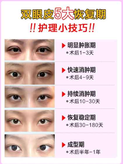 开眼角会让眼睛变大吗？开眼角手术是否真的能让眼睛变大