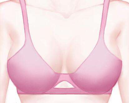 曹洪扬医生口碑怎么样？胸部整形医生推荐 | 时光整形插图3