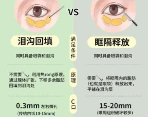 李文鹏医生怎么样?杭州连天美脂肪整形插图1 李文鹏医生怎么样?杭州连天美脂肪整形插图1