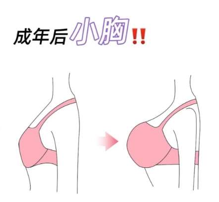 张墨林医生口碑怎么样？胸部整形医生推荐 | 一美整形插图2