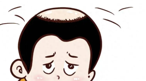 上海植发王志勇 · 医生简介、技术特点、收费价格参考插图