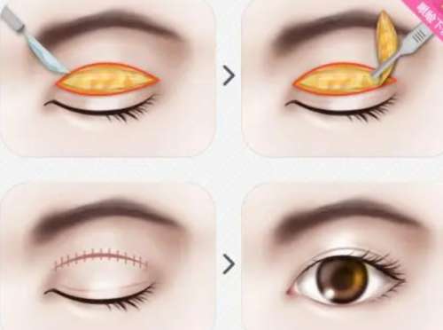 佛山南海区人民医院整形科坐诊医生信息一览|高海霞医生信息披露！插图1