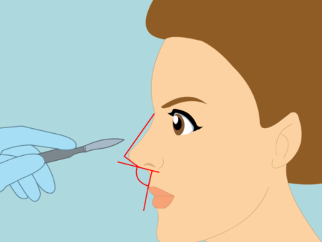 上海首尔丽格朴相根隆鼻和洪性范谁更牛？2026韩式技术对比，各有千秋插图2