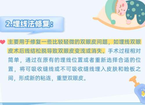 上海滕彦医生修复双眼皮如何？口碑点评+价格参考插图2