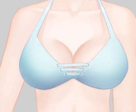 朱云医生口碑怎么样？胸部整形医生推荐 | 中家医家庭医生插图1