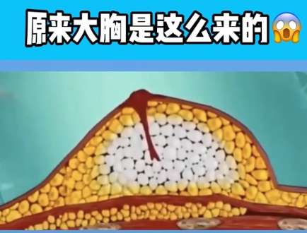 白金庄医生口碑怎么样？胸部整形医生推荐 | 武汉星月汇医疗美容医院、武汉阿芙罗医疗美容医院院插图4