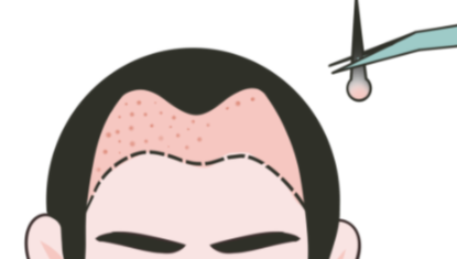 上海植发陈云锦 · 医生简介、擅长项目、收费价格一览插图