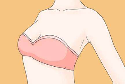 何元飞医生口碑怎么样？胸部整形医生推荐 | 宁夏华美整形插图3