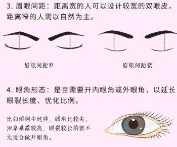 广州刘欢欢双眼皮价格贵吗？医生风格解析_含全新收费表插图4