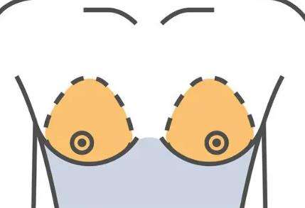 张冠勋医生怎么样-胸部整形-济南诺德美容插图2