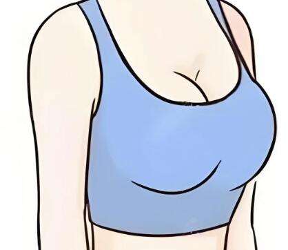 闫涛医生口碑怎么样？胸部整形医生推荐 | 蕾娜斯医美插图2