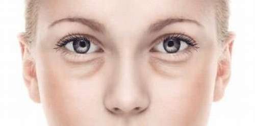 杨世界医生做眼袋手术怎么样？个性化定制、疤痕隐藏、注重眼周年轻化插图3