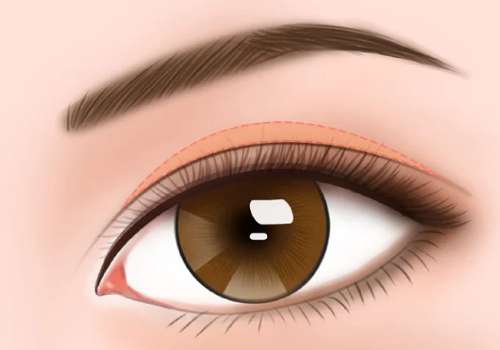 武汉严飞和广州赵利宾谁厉害?隆胸/双眼皮技术PK与顾客评价插图2