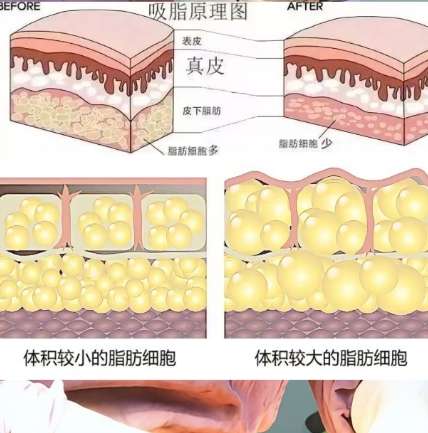 合川人民医院整形科挂号预约方式推荐|线上vs线下那种更可靠？插图3