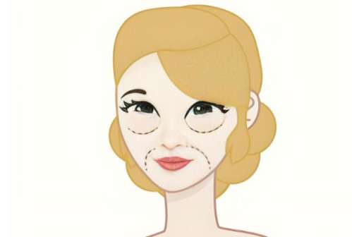 郑州脂肪填充罗明生介绍，有着相对高的安全性，操作技巧灵活插图2