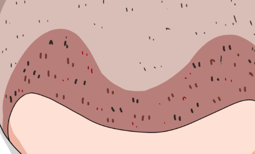 上海植发医生余新明：技术优势、案例展示、预约方式插图1