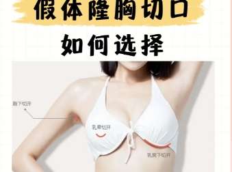 杨阳医生怎么样？胸部整形医生推荐 | 重庆五洲插图3