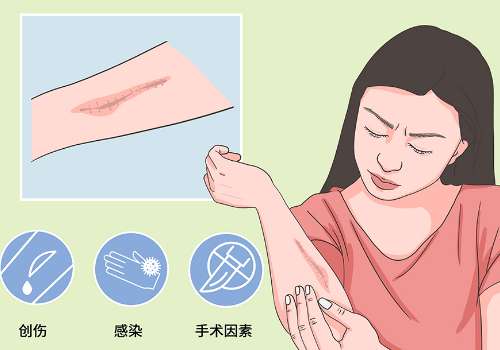 上海九院黄如林做疤痕怎么样？注射、激光、手术修复手段好插图1