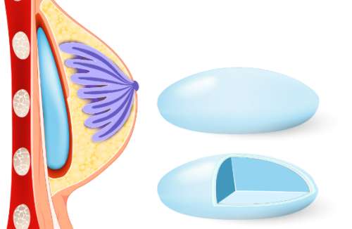 黄广香医生口碑怎么样？胸部整形医生推荐 | 中家医家庭医生插图1