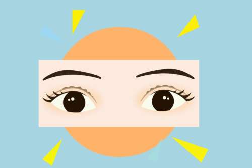 西安高一生张林宏医生双眼皮手术怎么样？解决眼睛无神的问题、术后美观度强…插图1