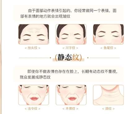 王志军医生口碑怎么样？面部年轻化 | 西安国际医学中心医院整形医院插图1