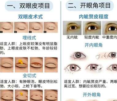 卢建建双眼皮修复价格贵不贵？技术怎么样？真实口碑测评插图4