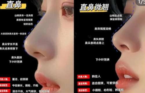 广州邓健隆鼻案例图展示！网友亲测术后效果自然！附医生简介插图1