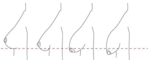 赵建华医生怎么样？胸部整形医生推荐 | 太原欧美莲医院插图4