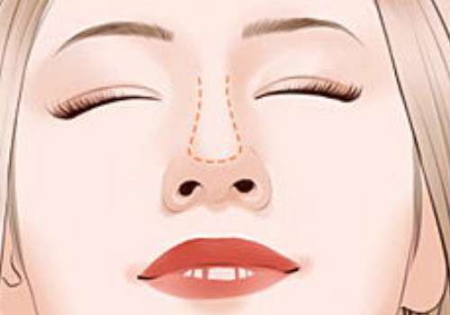 北京八大处陈光宇怎么样？隆鼻2万元起，真实案例分享插图2