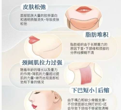 九院柴岗技术怎么样？做下颌角怎么样？经典案例展示插图4