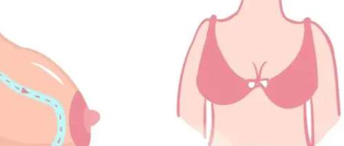 唐毅医生怎么样？胸部整形医生推荐 | 上海美莱插图4