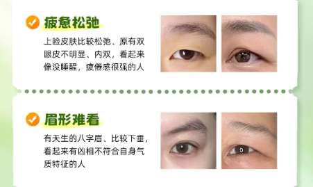 陈宝贵医生怎么样？胸部整形医生推荐 | 维密插图2