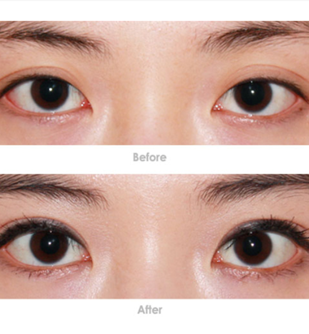 选择正规机构的重要性