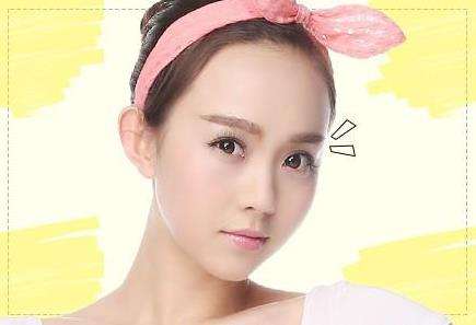 成浩医生眼修复怎么样？经验丰富、技术细腻度高、审美协调…插图2