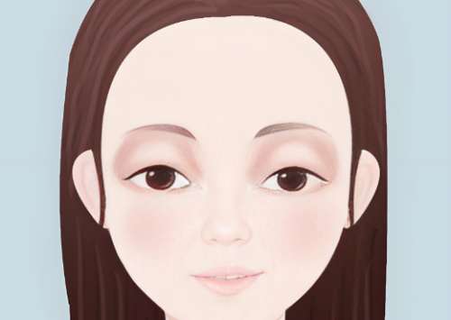 上海内切祛眼袋医生怎么选？李圣利、张余光、杨军手术路径与平整度反馈插图