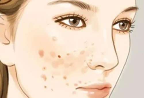 郑州人民医院整形科坐诊医生推荐|王剑、张喜兰、李正斌等当属实力派！插图4