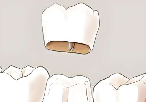 华西医院口腔科哪个医生好？张雅蓉、谢璐以及刘钧医生的实力在线插图1