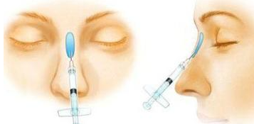 杭州梁敏雪医生擅长什么?眼鼻整形及面部年轻化项目一览插图