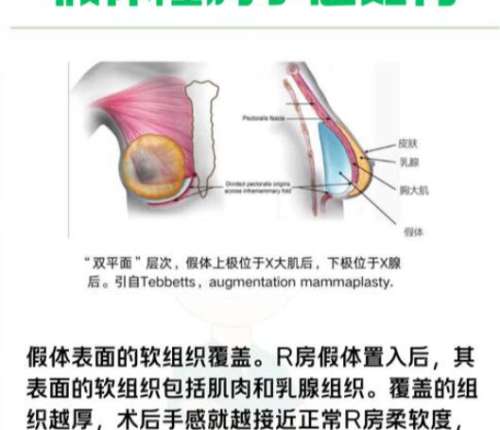 唐婷医生怎么样？胸部整形医生推荐 | 严塑抗衰插图4